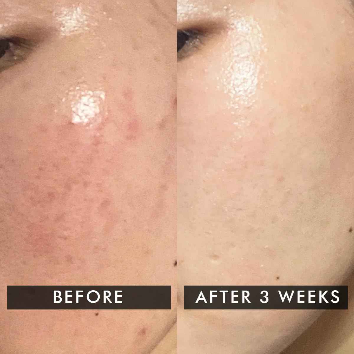 Conscious Chemist® Snail Magic Skin Barrier Repair All In One Cream | Daily Repair Gel Cream with Korean Snail Mucin Extract | 50g / 1.7fl.oz