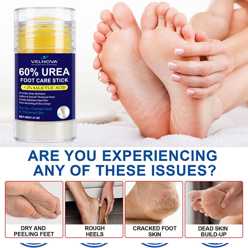 Velnova 60% Urea Foot Care Stick with 2% Salicylic Acid – Callus Remover & Intensive Moisturizer, 1.41 oz