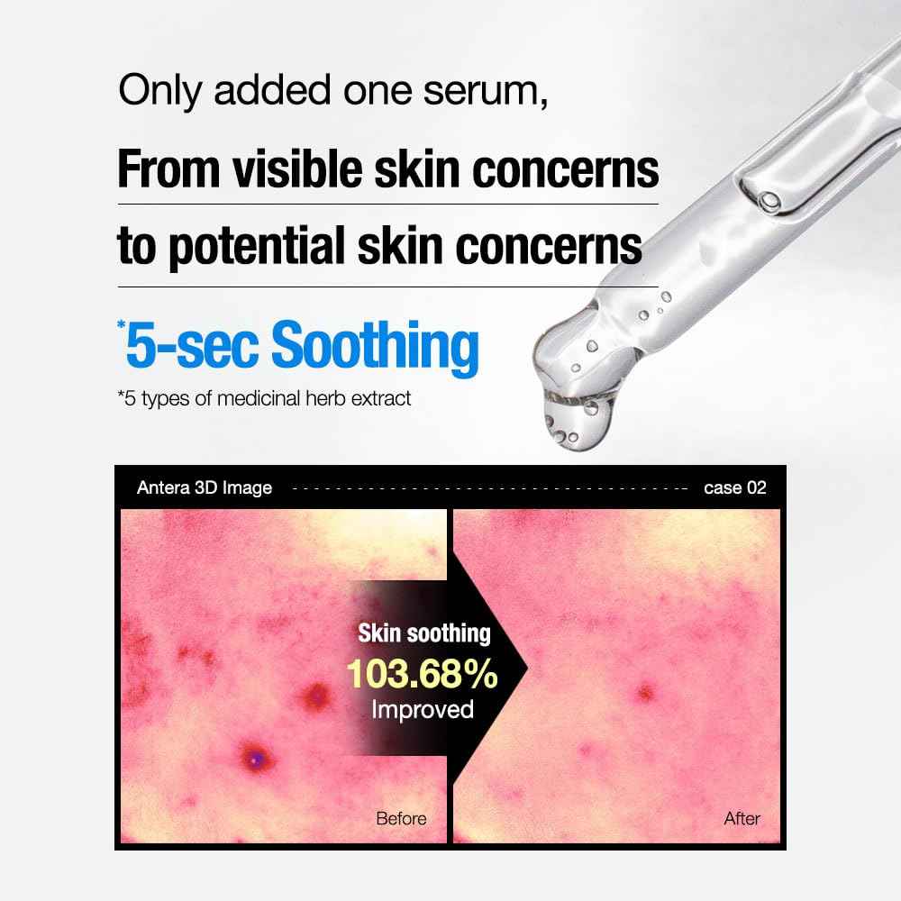 Feld Apotheke PHYTO CALM SERUM, PhytoCalm Anti-Blemish, 5-Herb Hydration & Soothing Serum, Soothes Skin Irritation, Supports Clear Skin, 1.01fl.oz/30ml