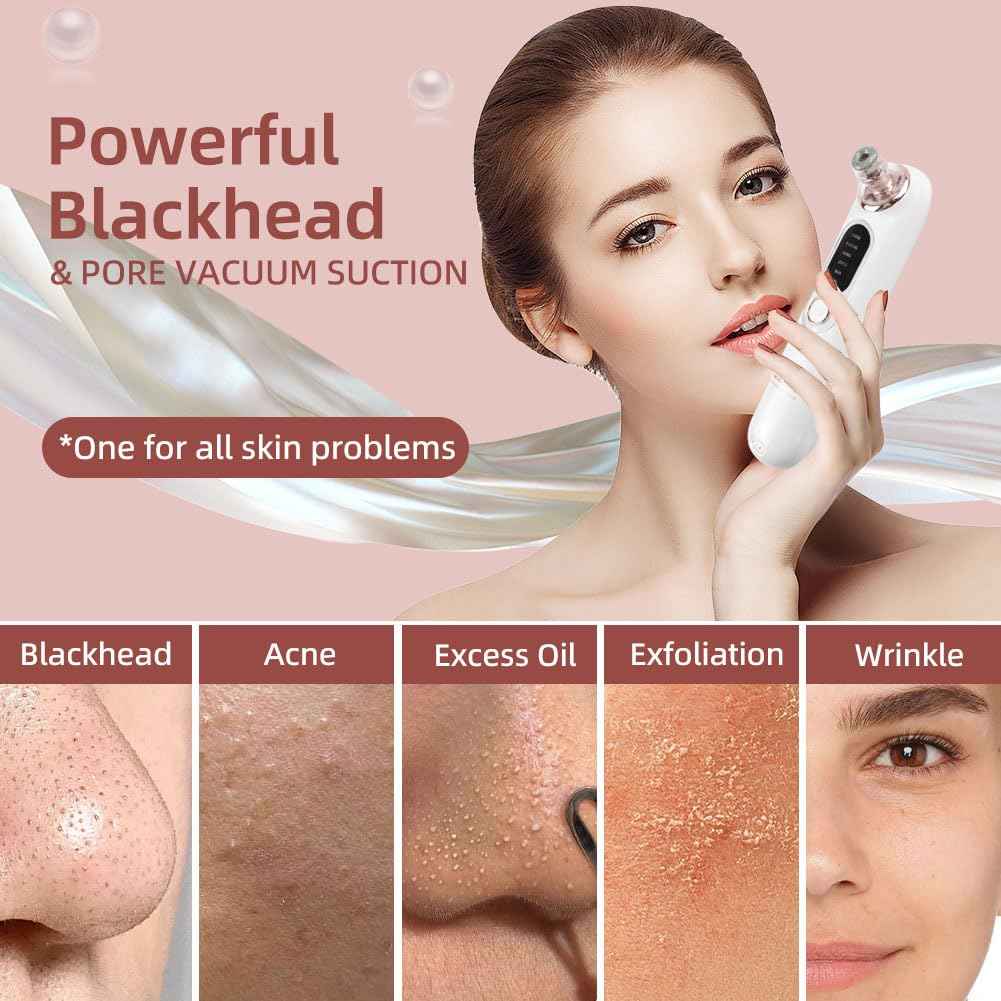 5-Speed Blackhead Remover Vacuum, Wireless Charging Nose Pore Extractor with 4 Removable Heads,Facial Vacuum Pore Cleaner,30-Second Keratin Softening, Hypoallergenic Deep Cleansing
