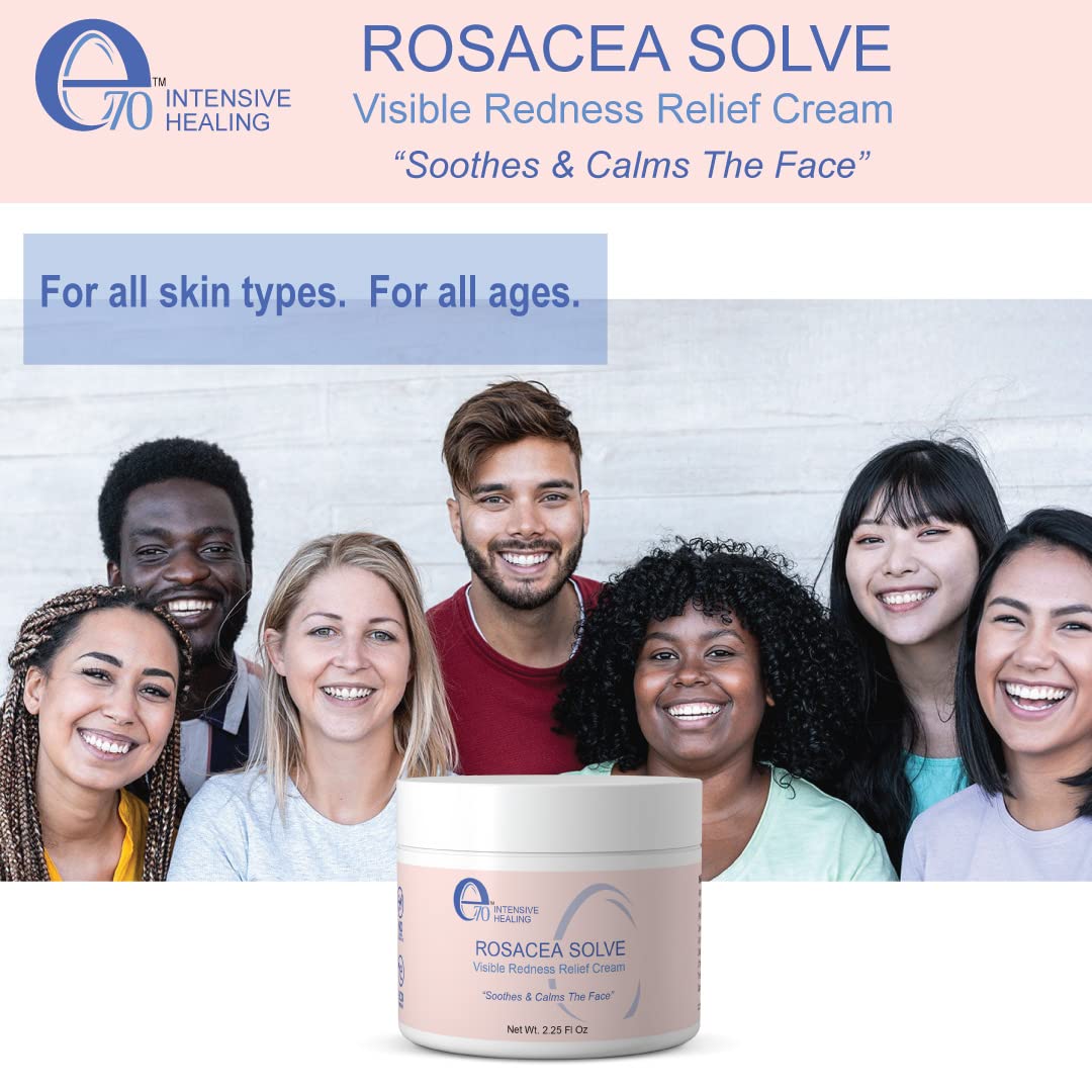 e70 Rosacea Solve - Redness Relief Cream - Face Moisturizer For Rosacea & Acne Prone Skin - Skin Care With Organic Ingredients, Almond Oil, Licorice and Chamomile Extracts - No Parabens (Pack of 2)