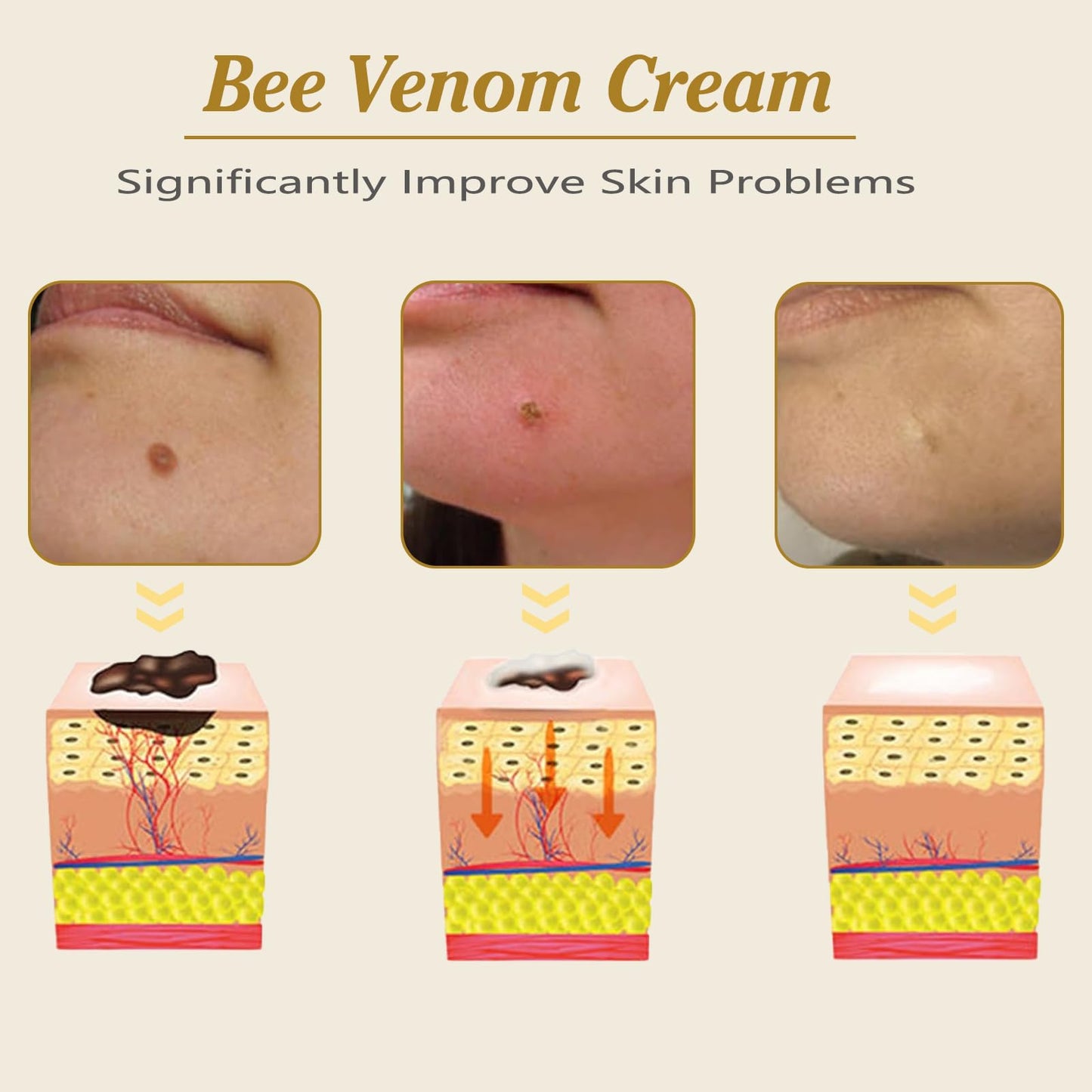 Simbity 2024 New Bee Venom Cream,Professional Bee Venom Repair Cream for All Skin Types Moisturizing Cream (1PCS)