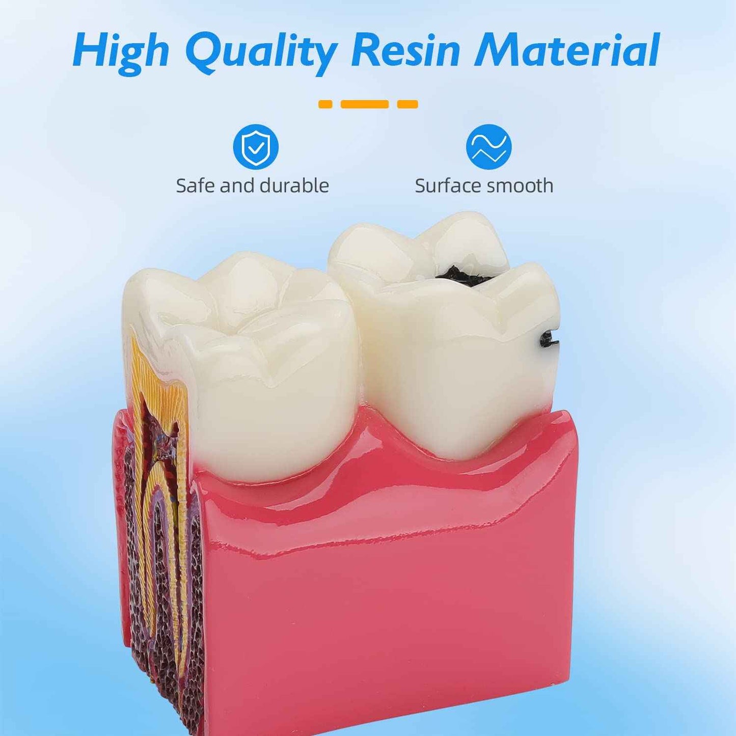 faruijie Dental Caries Tooth Model - 6 Times Caries Anatomy Dental Care Teeth Model Decay Teeth Comparative Education Model Dental Model Teaching for Patient Education