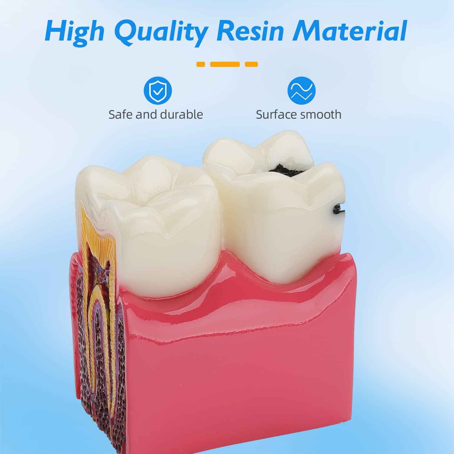 faruijie Dental Caries Tooth Model - 6 Times Caries Anatomy Dental Care Teeth Model Decay Teeth Comparative Education Model Dental Model Teaching for Patient Education