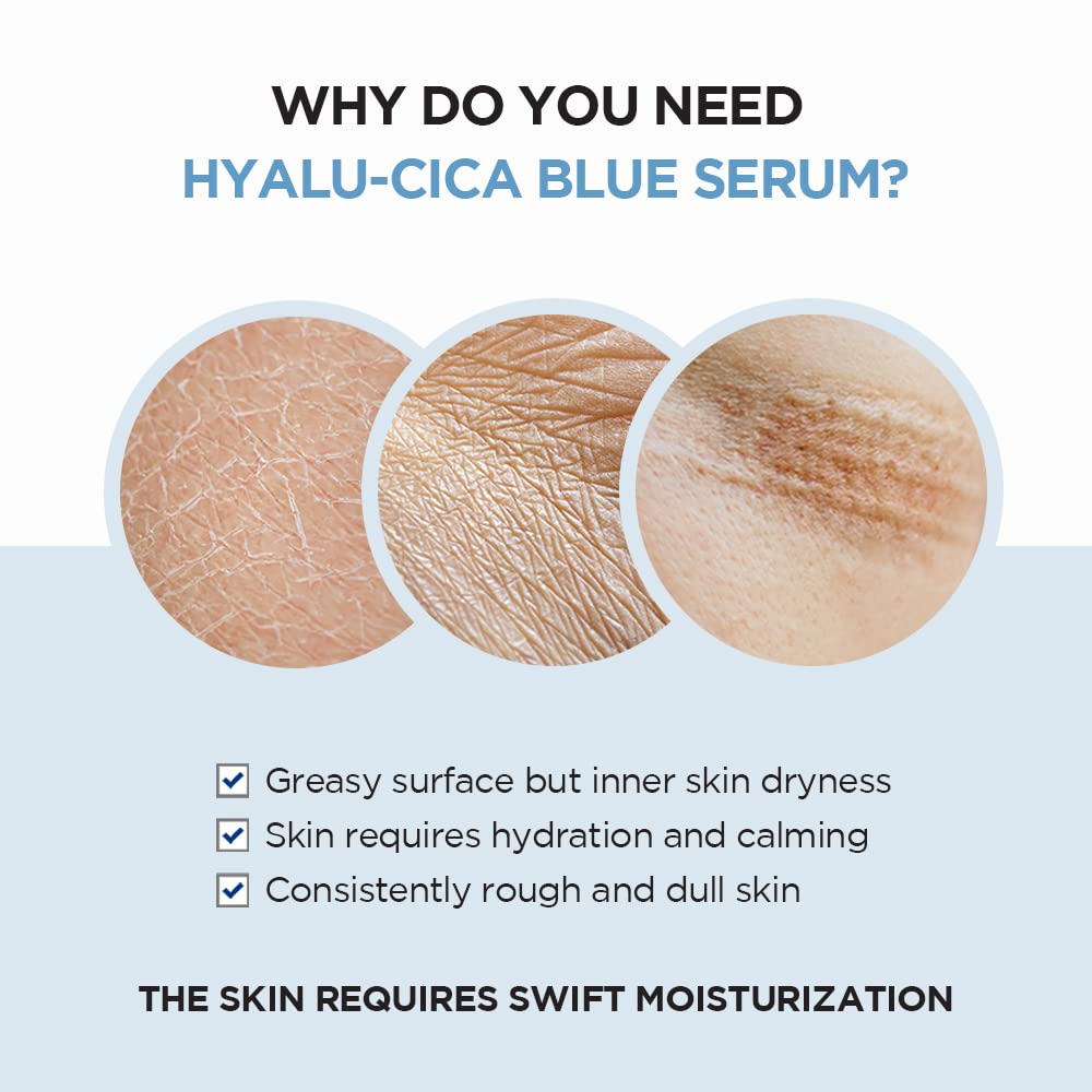 SKIN1004 Hyalu-CICA Blue Serum 1.69 fl.oz, 50ml, 5 Layer Hyaluronic Acid Cica Niacinamide, Hydrating and Refreshing Multi-Care Solutions