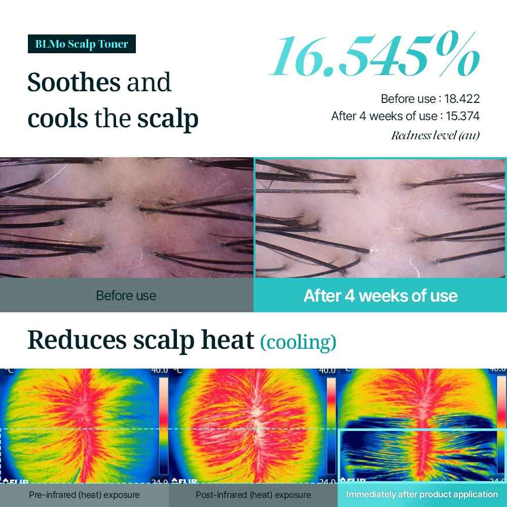 Scalp Serum for Hair Loss & Thinning with Massaging Tips | Clinically Proven | Thickens & Accelerates Hair Growth | Supports DHT Balance | Korean Hair Care | Low Irritation, Drug-Free | 4.05 fl.oz