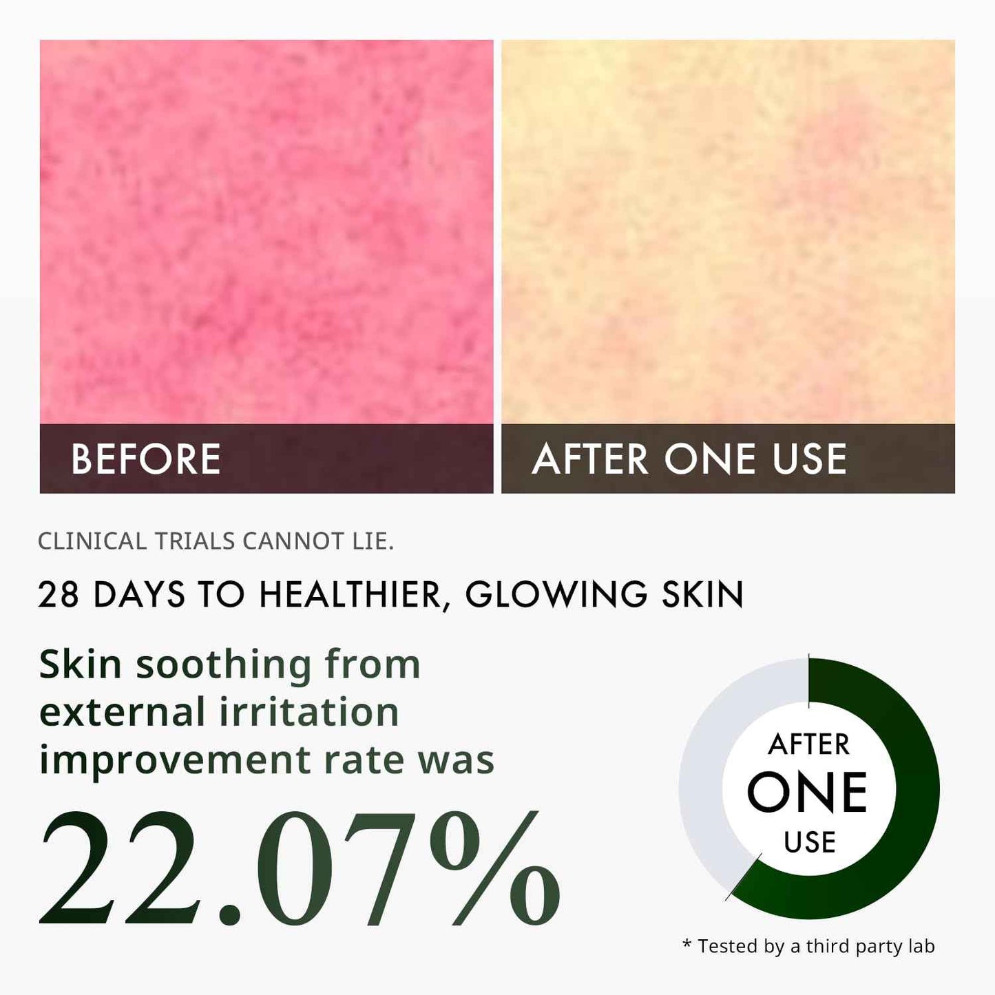 Depology CICA H.A Calm & Repair Serum | Reducing Discomfortable and Sensitivity Face Serum | Hydrating & Replenishing Facial Skin Care Product | Providing Relief from Redness Serum 1.01 fl.Oz