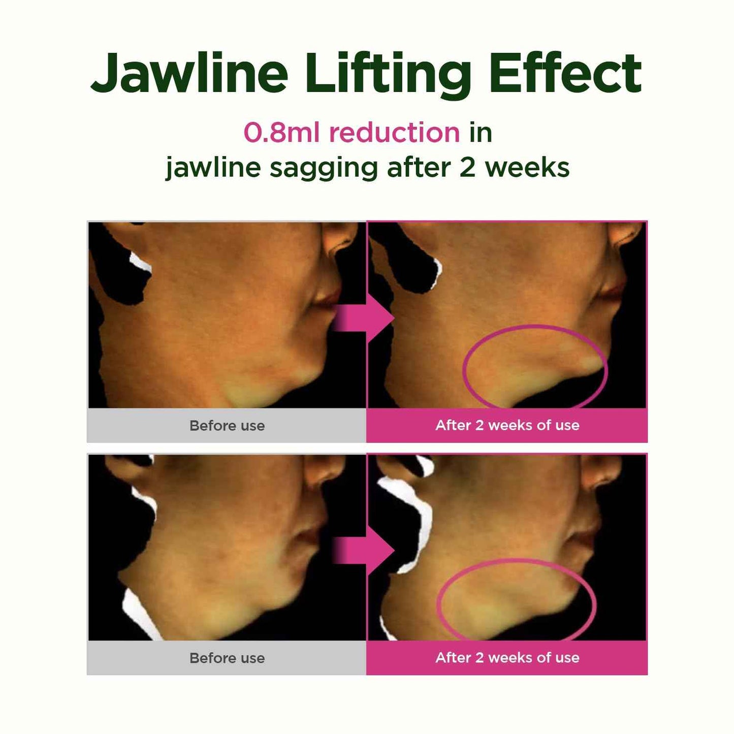 CKD Retino Collagen Gua Sha Neck Cream - Firming Cream for Neck and Jawline Tightening, Lifting, and Wrinkle Reduction with Stainless Steel Roller. Korean Skin Care,1.69 fl oz.