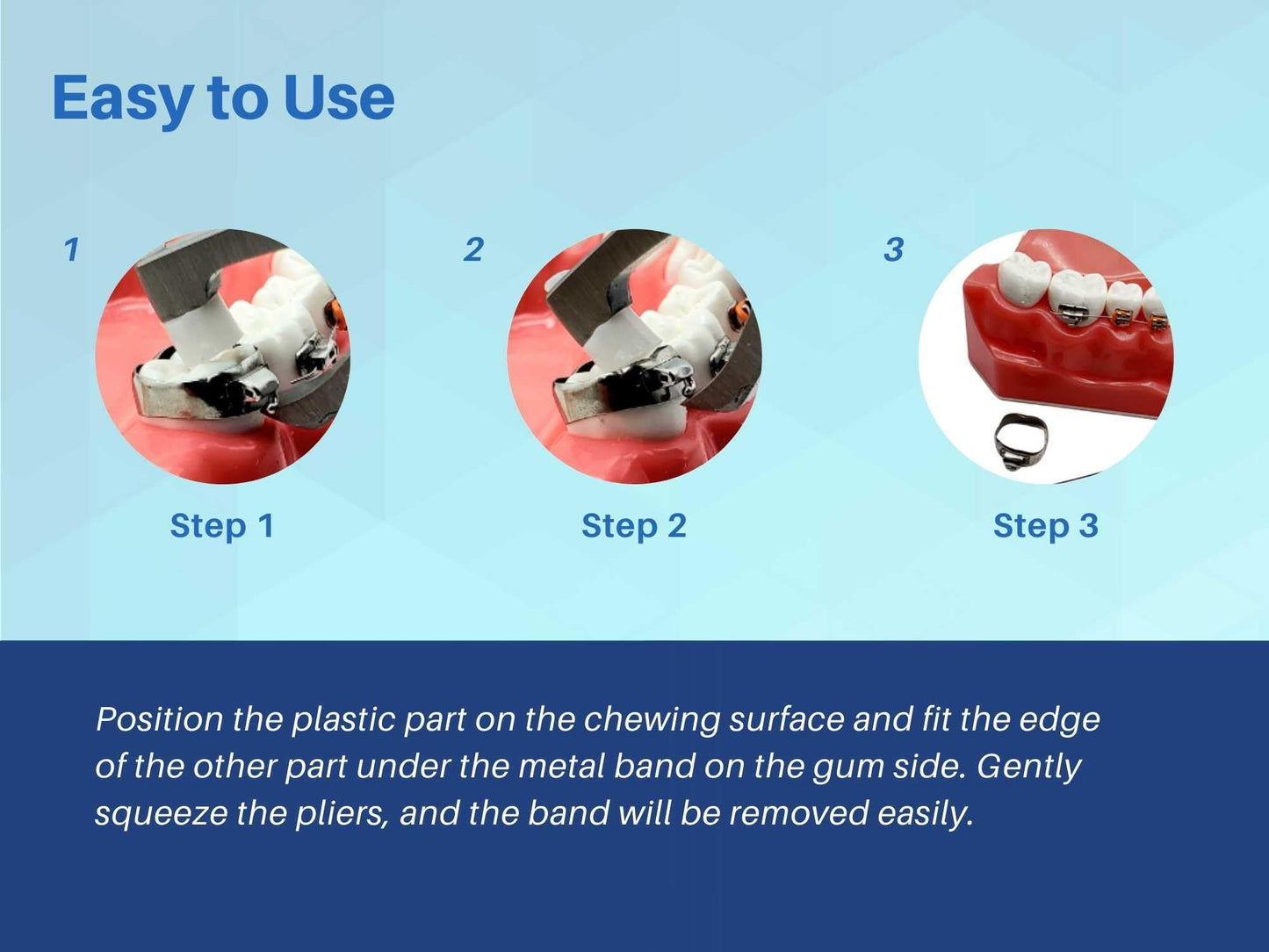 ARTMAN INSTRUMENTS Molar Band Remover Pliers – Orthodontic Braces Removal Tool – Stainless Steel, Autoclavable, Dental Braces Band Removing Pliers