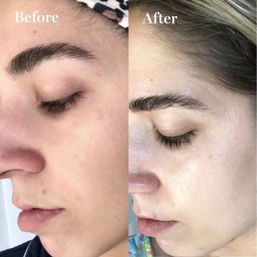 Face Moisturizing Mini Size Cream with Carrot, Niacinamide, Ceramides & Centella Asiatica, Peptide, Paraben-Free, Sulfates-Free, Fragrance-Free, Anti Wrinkle Facial Cream Made in Korea (1.01 Ounce)