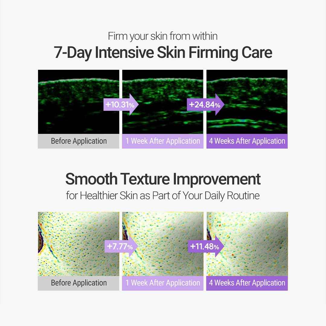 ROVECTIN Retinosine Deep Intense Cream - Retniol 0.15%, Adenosine, Hydrolyzed Collagen, Bakuchiol | For sensitive skin, Korean Skin Care - (1.01 fl.oz, 30ml)