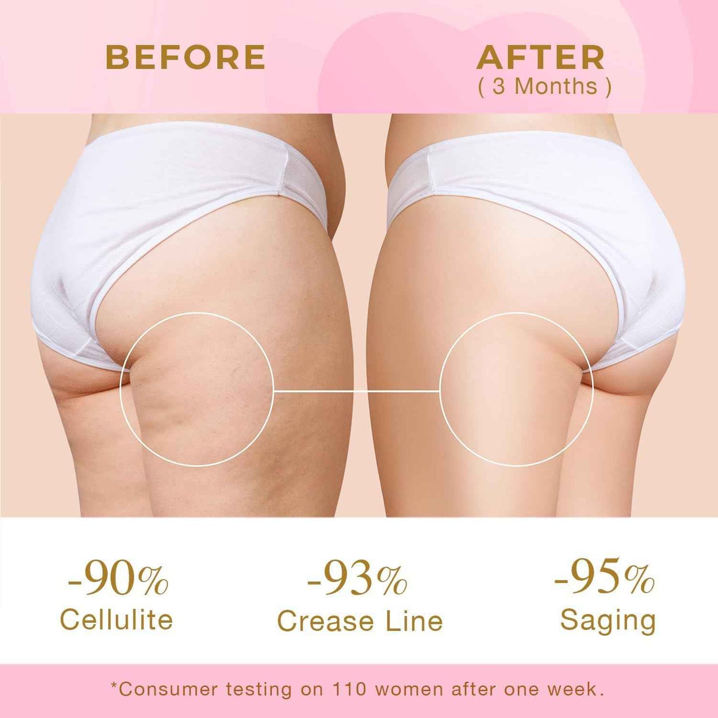 Skin Tightening Cream for Body: Cellulite Cream for Toning and Lifting Thighs, Butt, and Legs – Reduces Sagging Skin and Enhances Curves for a Youthful Look