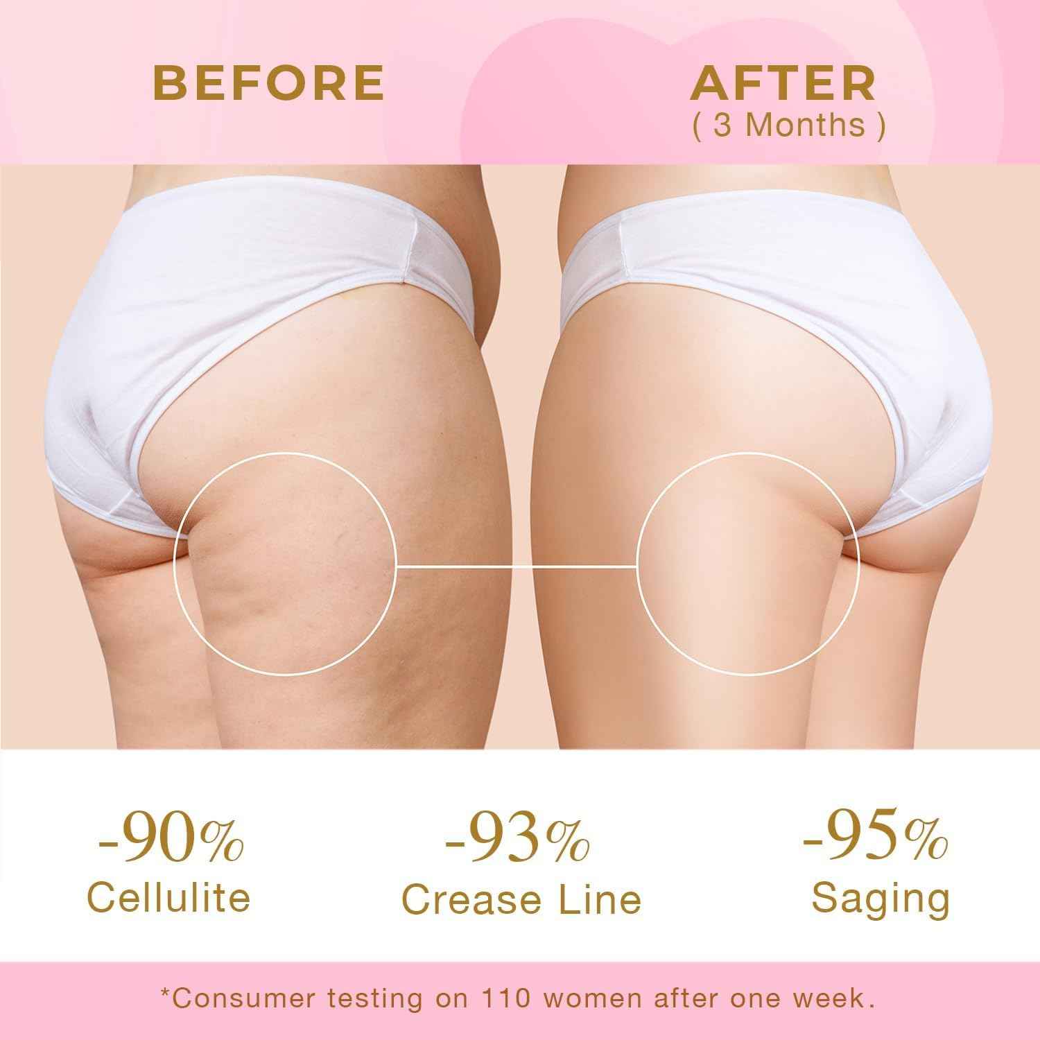 Skin Tightening Cream for Body: Cellulite Cream for Toning and Lifting Thighs, Butt, and Legs – Reduces Sagging Skin and Enhances Curves for a Youthful Look