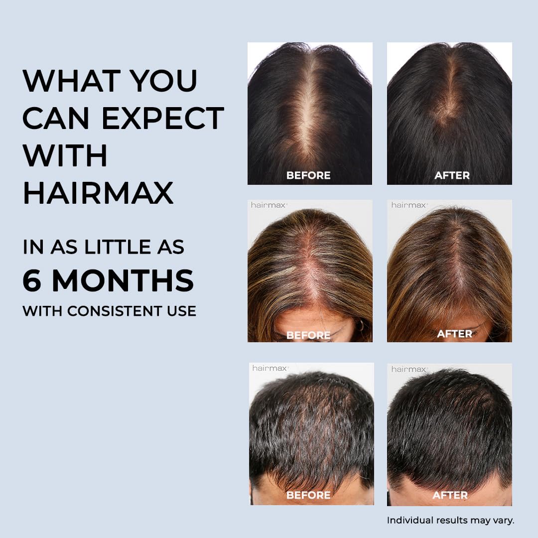 Hairmax Laser Hair Growth Cap, FDA Cleared, PowerFlex 272 Hair Laser Growth Treatment for Men & Women, Thinning Hair Treatment Full Coverage, Laser Diodes Maximize Hair Growth -