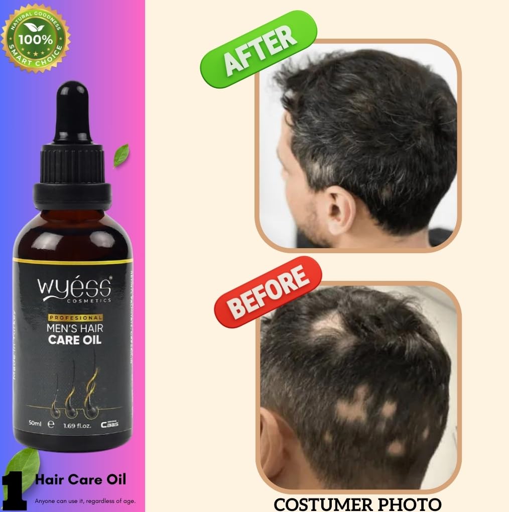 WYESS Natural Argan Oil Serum for Men's Hair Growth, Stimulating and Easy to Use