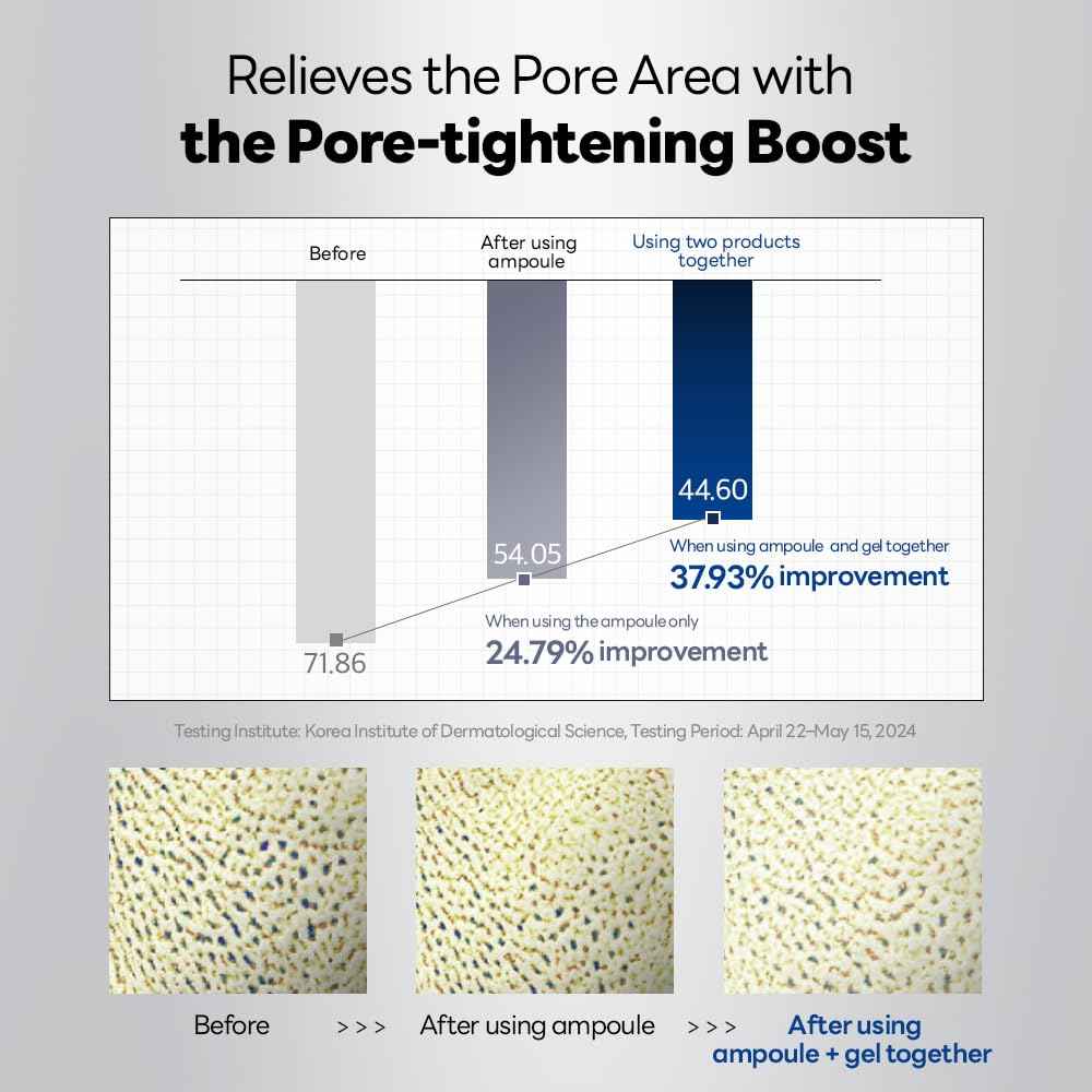 Mediheal Collagen Spicule 3000ppm Intensive Serum – Micro Needle Serum for Pore Care, Soothing & Skin Texture Improvement, 2-Step Pore Care Set,Collagen Spicule Ampoule and Gel Mask Set,4 pcs