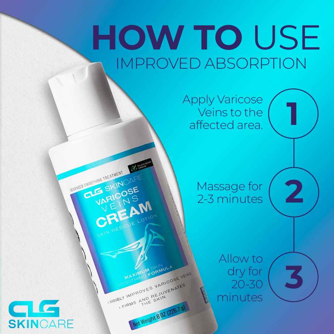 CLG Skincare Varicose Veins Cream - Skin Rescue Lotion for Smoother, Healthier Legs - Advanced Formula for Varicose Veins Improvement, Circulation & Skin Firming, Plant-Based Ingredients, 8 oz (1)