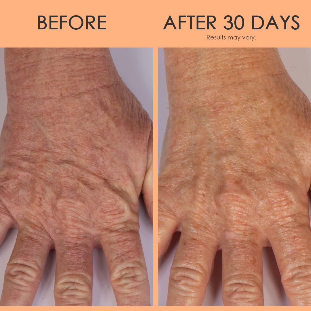 Crépe Erase Advanced Anti Aging Hand Repair Treatment with TruFirm Complex