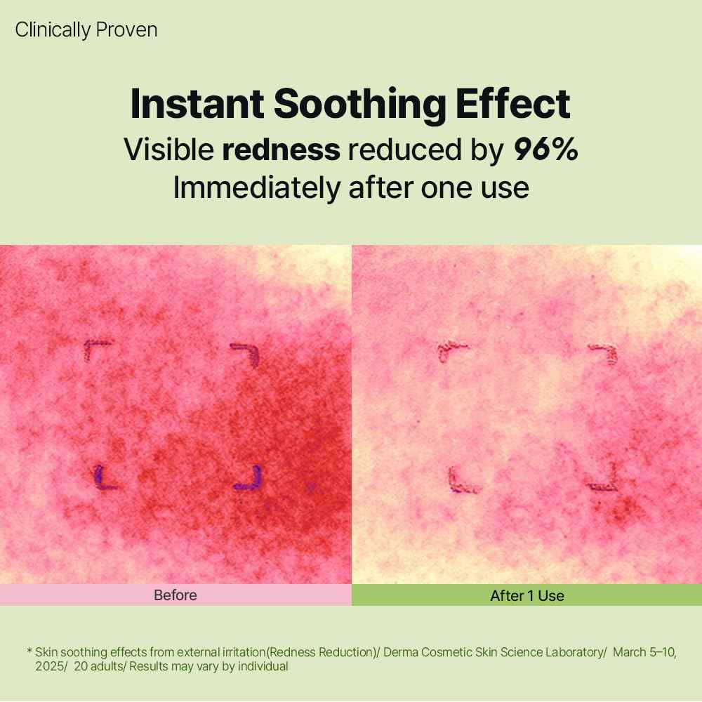 DearMYDEW HYCICA Soothing Balance Cream Moisturizer | Calming Hydration Barrier Care for Sensitive Skin, Centella, Ultra-Low Molecular Hyaluronic Acid, Vegan Fragrance-Free Korean Skincare, 2.70 fl oz