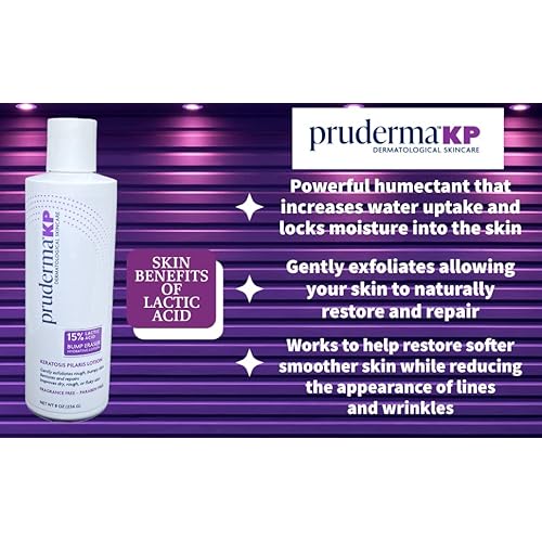 KP Keratosis Pilaris Treatment, KP Bump Eraser Hydrating lotion, Bumps Be Gone, Moisturizing and exfoliating lotion For Rough and Bumpy Dry Skin For Body, 8 Oz