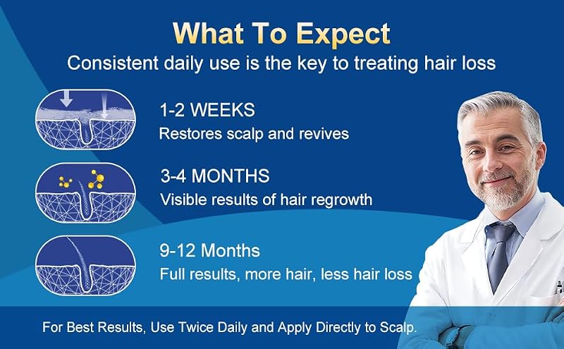 Minoxidil Foam for Men - Hair Regrowth Treatment with Biotin, 5% Strength, 5 Pack