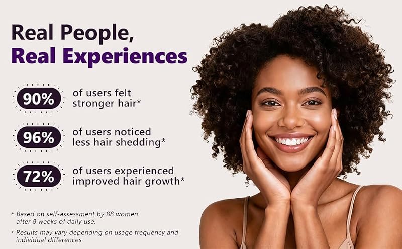 5% Minoxidil Hair Growth Serum for Women with Biotin - 15ML