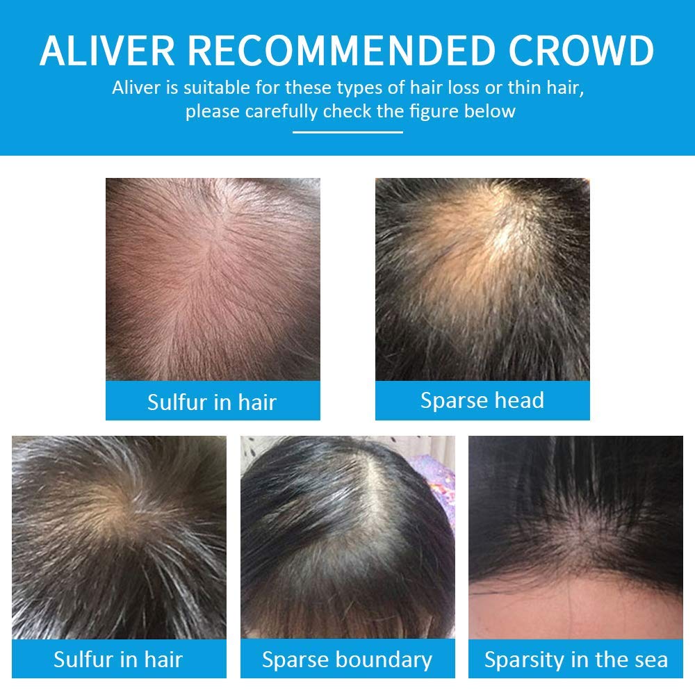 Aliver Fibers for Thinning Hair & Spray - Black - 27.5 Gr, Undetectable Natural Formula - Thicker Fuller Hair in 15 Seconds - Conceals Hair Loss & Look Younger - Designed for Men & Women