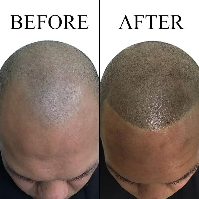 Nuva Scalp Micro-Pigmentation Ink Light Brown - SMP Pigment