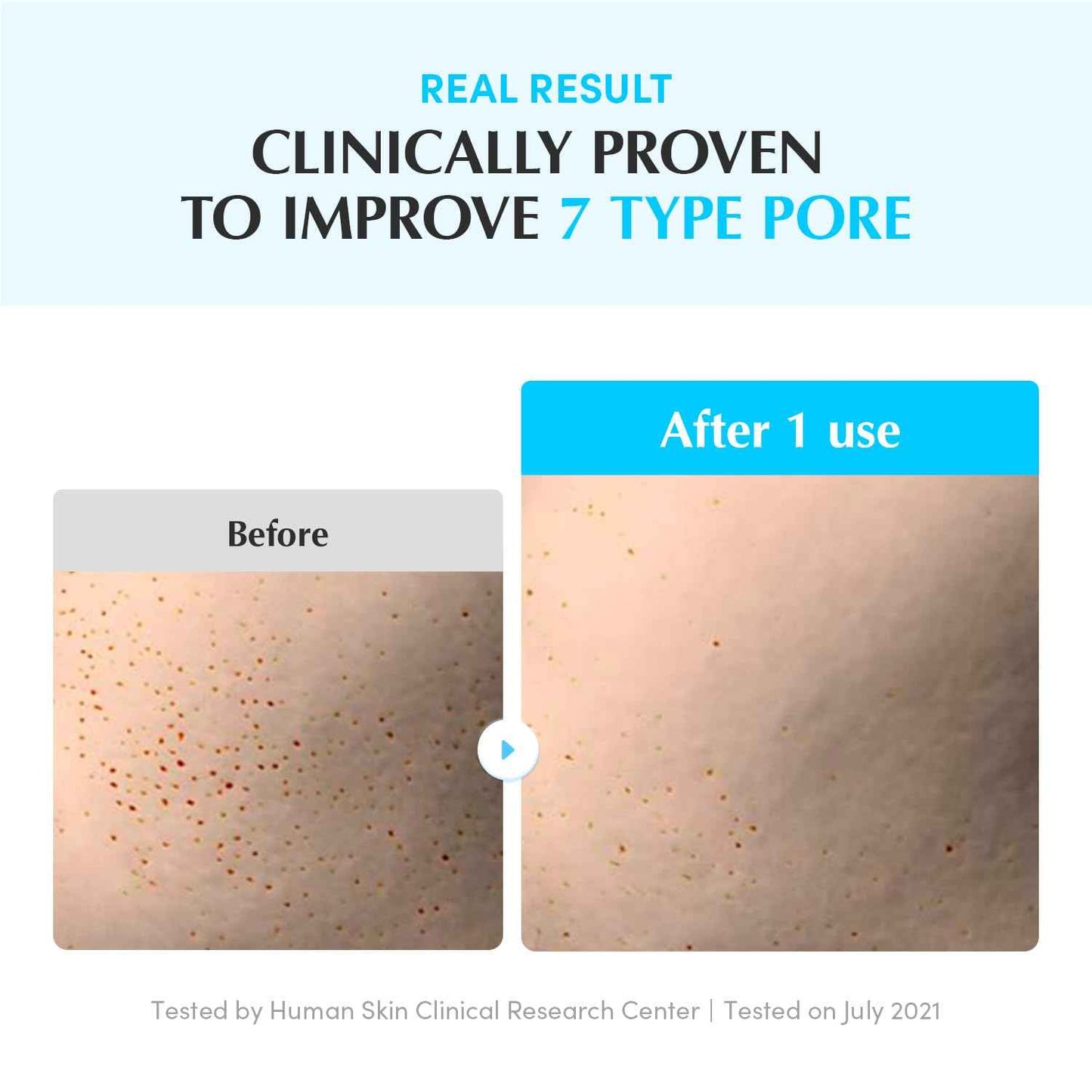 EQQUALBERRY Swimming Pool Ampoule - Hyaluronic Acid Serum for Glass Skin | Deep Hydration and Soothing with CICA Extracts | Korean Skin Care Serum, 1.69 Fl. Oz. 50ml