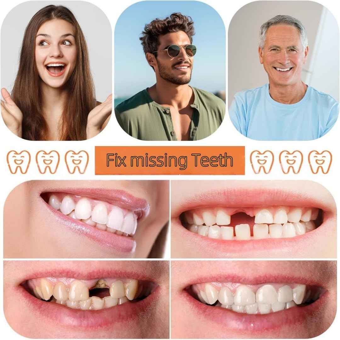 DIY Denture Temporary Veneers Kit for Women and Men, Upper and Lower Tooth Replacement Kit, Nature and Comfortable (1 Count (Pack of 1)