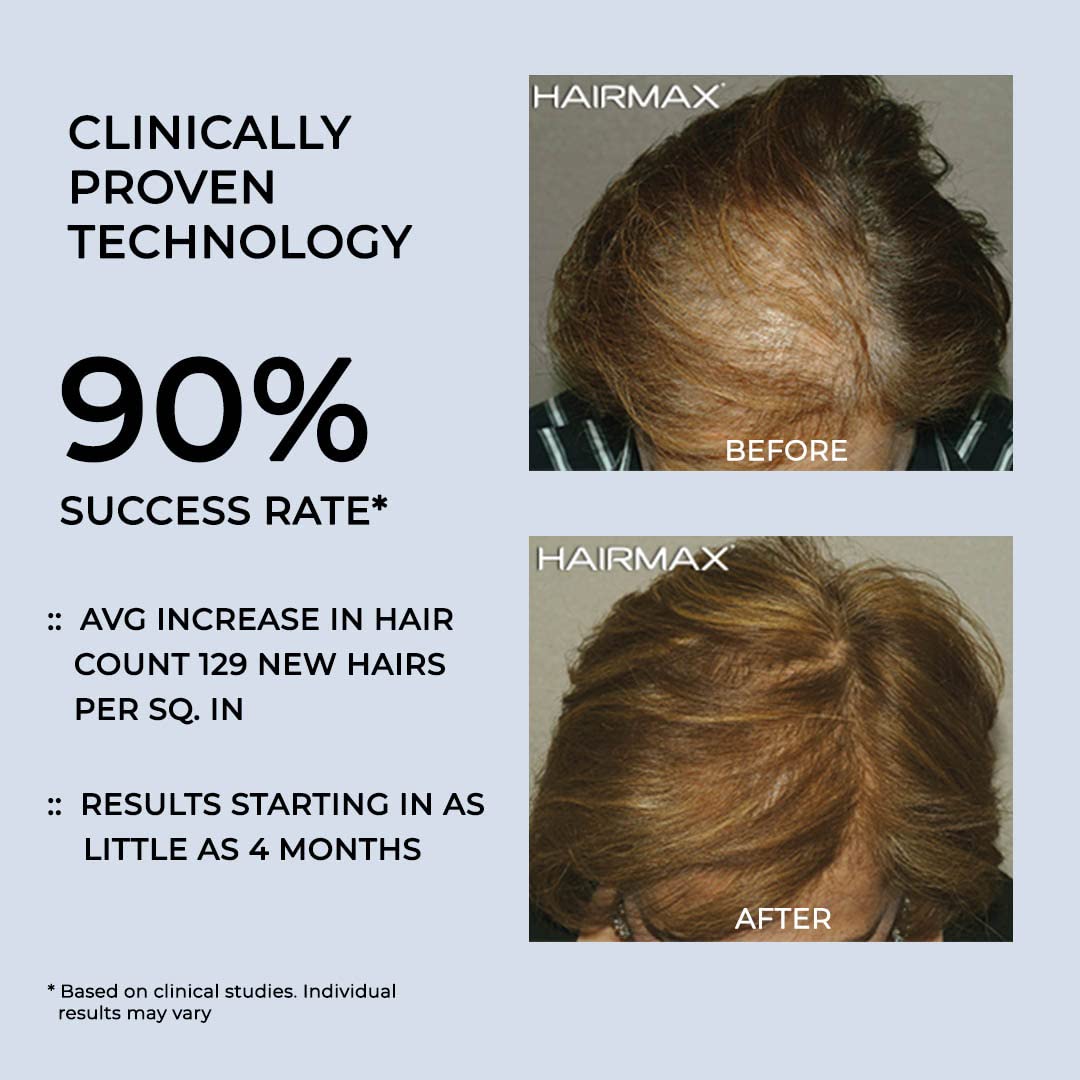 Hairmax Hair Growth Laser Band (FDA Cleared), LaserBand 82 ComfortFlex, Full/Partial Coverage, Hair Growth for Men & Hair Regrowth for Women, Hair Laser Growth, (100% Medical Grade Lasers, Not LEDs)