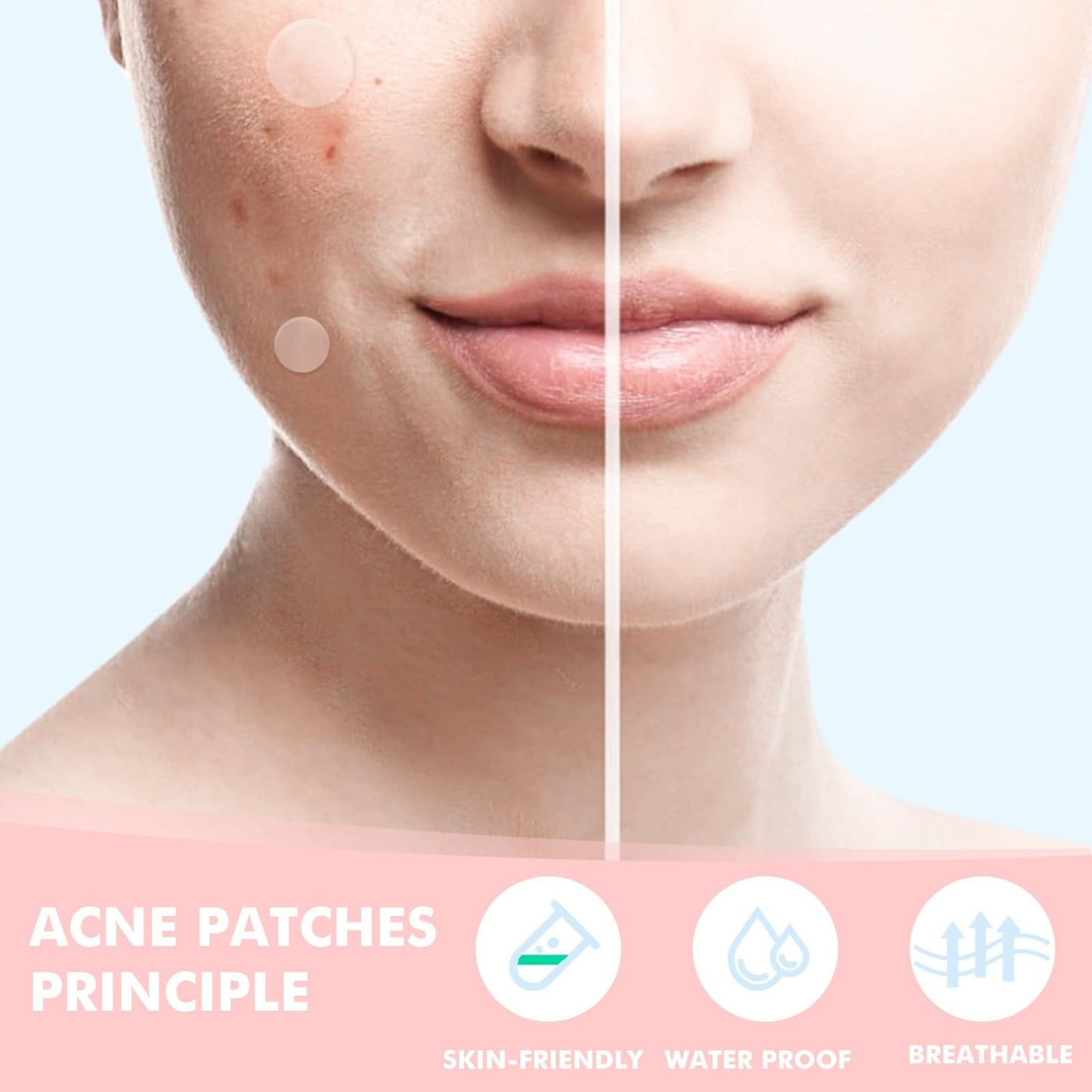 Pimple Patches for Face 304pcs,Hydrocolloid Acne Patches Star,Zit Patches,Pimple Popper Tool Kit,Facial Skin Care Products Containing Salicylic Acid,Tea Tree Oil and Calendula Oil