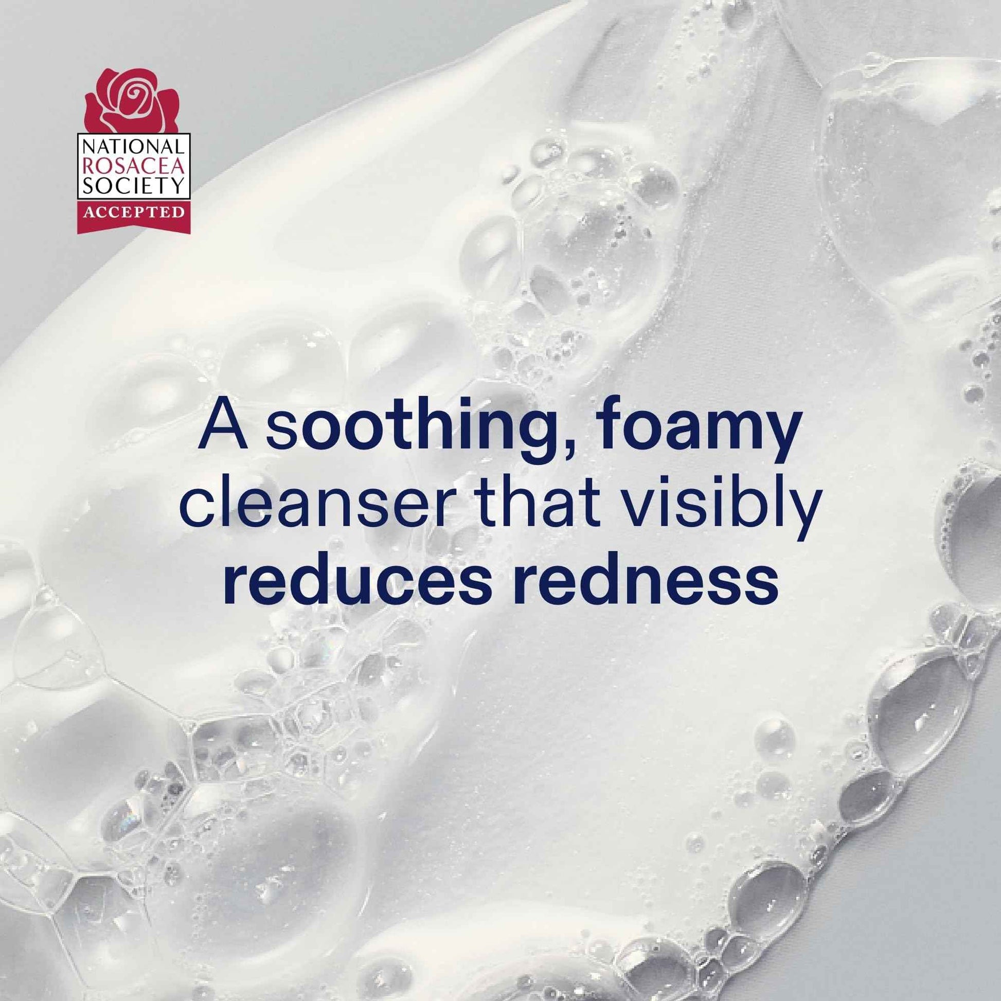 Skinfix Foaming Oil Cleanser for Face - 6 oz - Rich Gel-to-Foam Formula to Hydrate & Soothe Dry, Sensitive Skin - Fragrance Free, Vegan, Cruelty Free