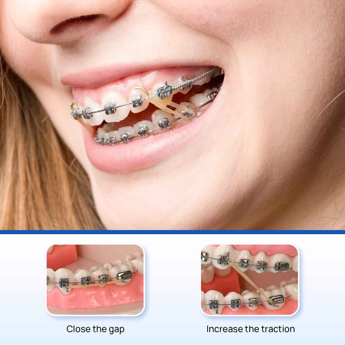 JMU Orthodontic Elastics 3/16 Heavy, 100 Pack Orthodontic Rubber Bands, Intraoral Elastic Bands Latex Dental Rubber Bands Made in USA