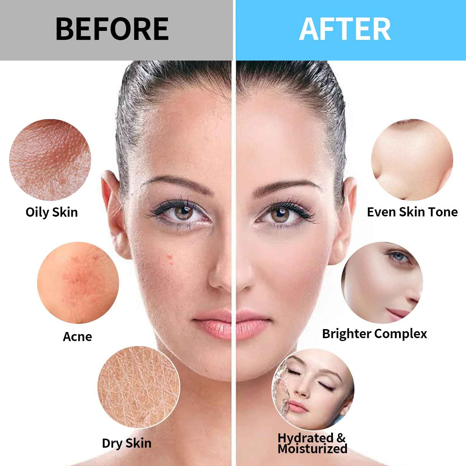 Nielies Jelly Face Mask For Facials | Bundle of 24K Gold & Vampire+ Hyaluronic Acid Hydrating And Brightening HydroJelly Masks | Vajacial