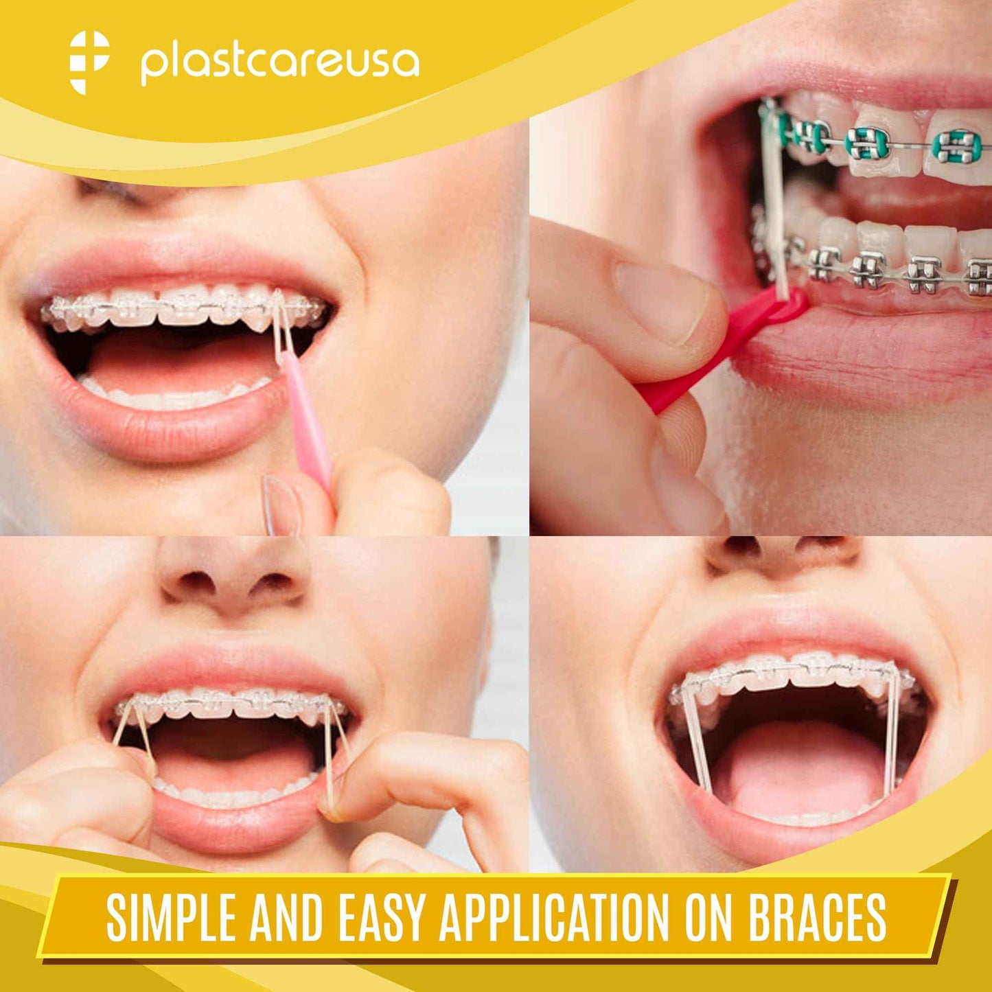 1000 (3/16" Rabbit, Heavy 6.5 Oz) Orthodontic Latex Elastic Rubber Bands for Braces - Multi-Size Dental Elastics Kit, Heavy-Duty Ortho Bands for Gap Closure & Teeth Alignment (10 Bags of 100)