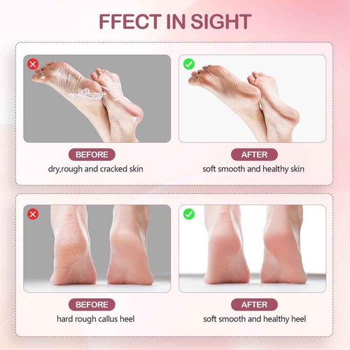Cordless Electric Foot Callus Remover,Rechargeable Grinder Tool for Feet Dead Skin,Professional Pedicure File Heel Sander with 60pcs Replacement Sandpaper Pads(Pink)