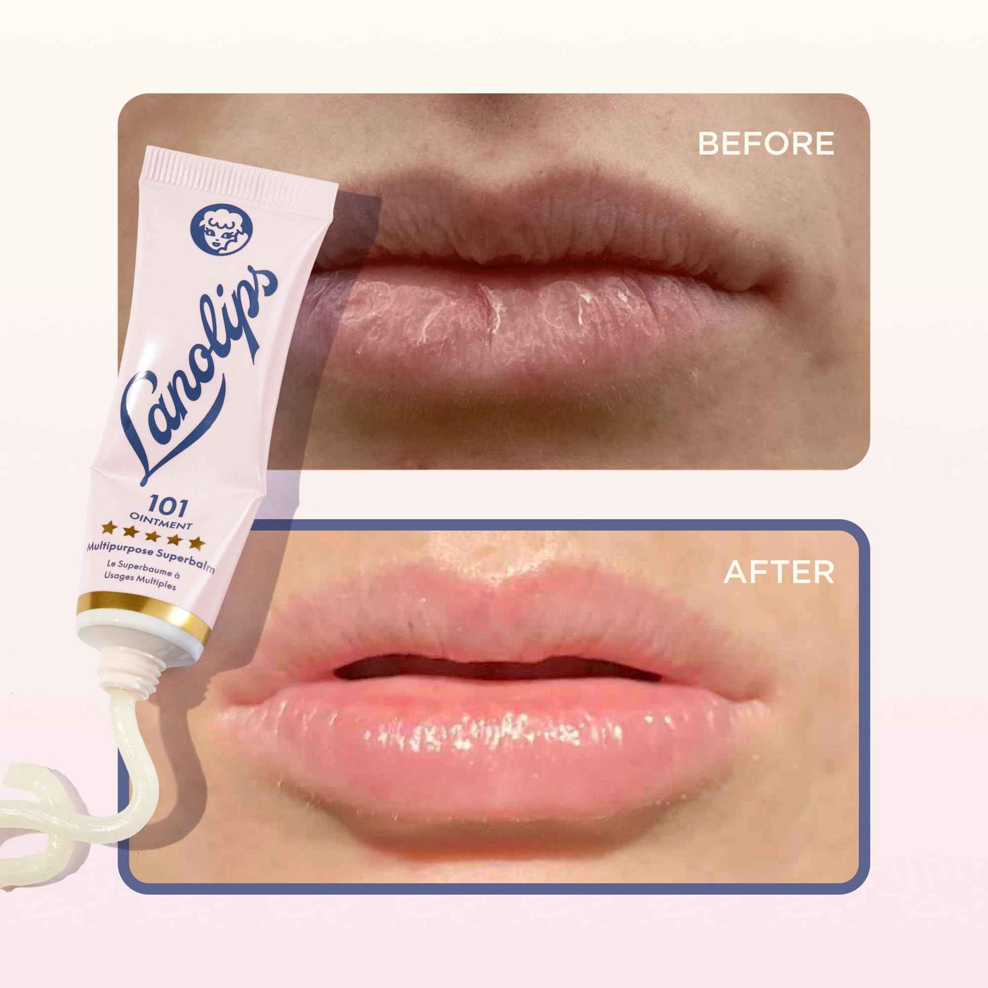Lanolips 101 Ointment Multi-Balm Duo, Original Superbalm - Contains Pure Lanolin Oil for Smooth, Hydrated, & Healthy Lips - Natural Lip Balm for Dry Lips, Cuticles, & More (2-Pack, 0.52 oz each)