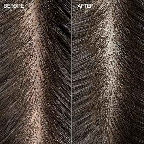 Tea Tree Special Detox Kombucha Rinse, Removes Buildup, Adds Shine, For All Hair Types