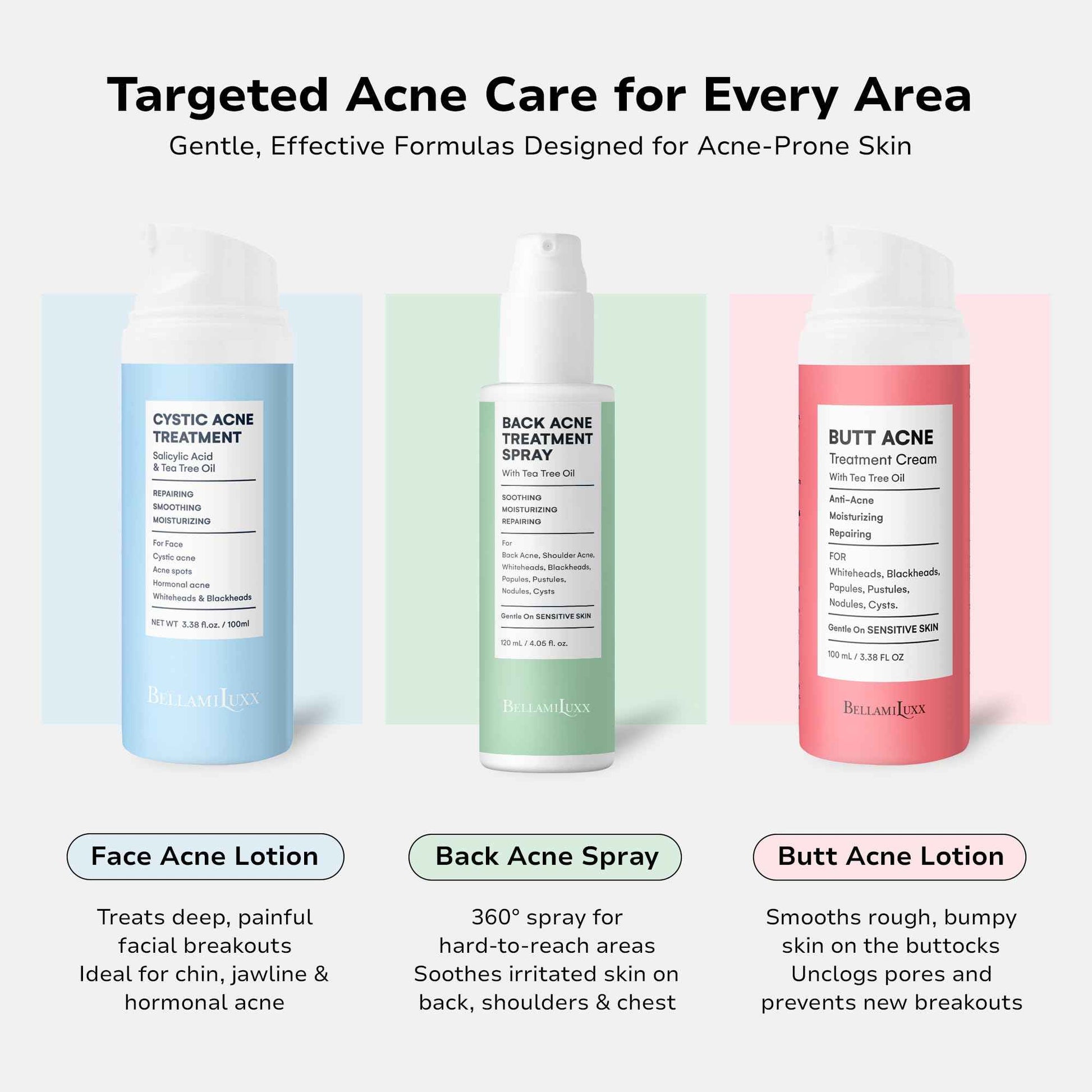 BellamiLuxx Fungal Acne Treatment Lotion: Effective Face & Body Pimple Cream for Bumps, Clusters, Itch & Redness – Fungal Prone Skin Acne Treatment Moisturizer for Teens & Adults with Natural Actives