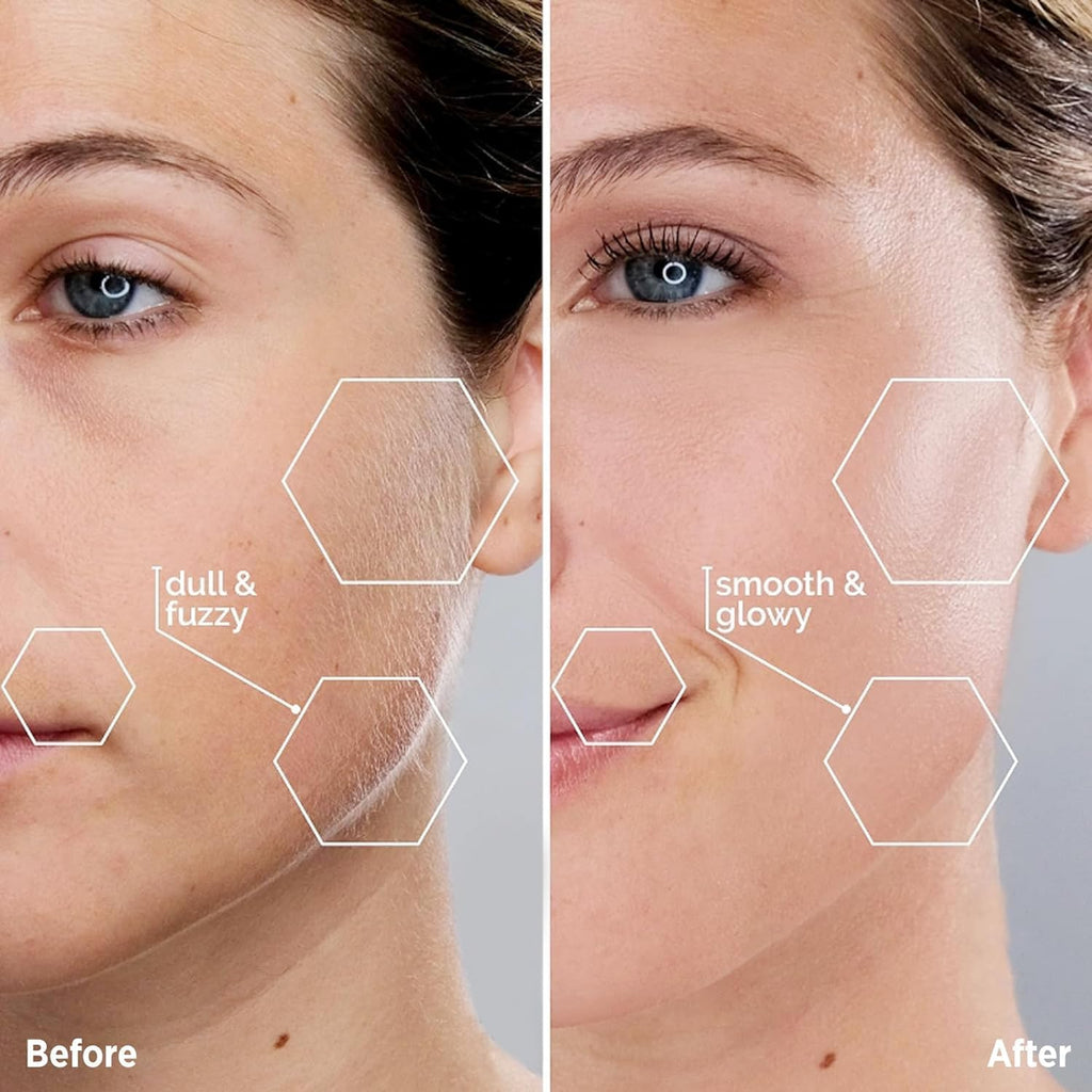 Facial Hair Removal for Women - Painless Facial Hair Remover - Electric Hair Removal Device for Face Lips Peach Fuzz with Light (Rose Gold)