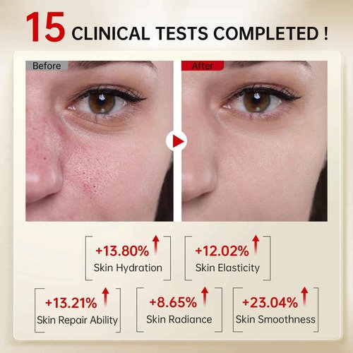 Bakuchiol Retinol Serum, 1% Retinol for Anti-Aging and Anti-Wrinkle, Gentle Yet Potent Formula for Sensitive Skin.