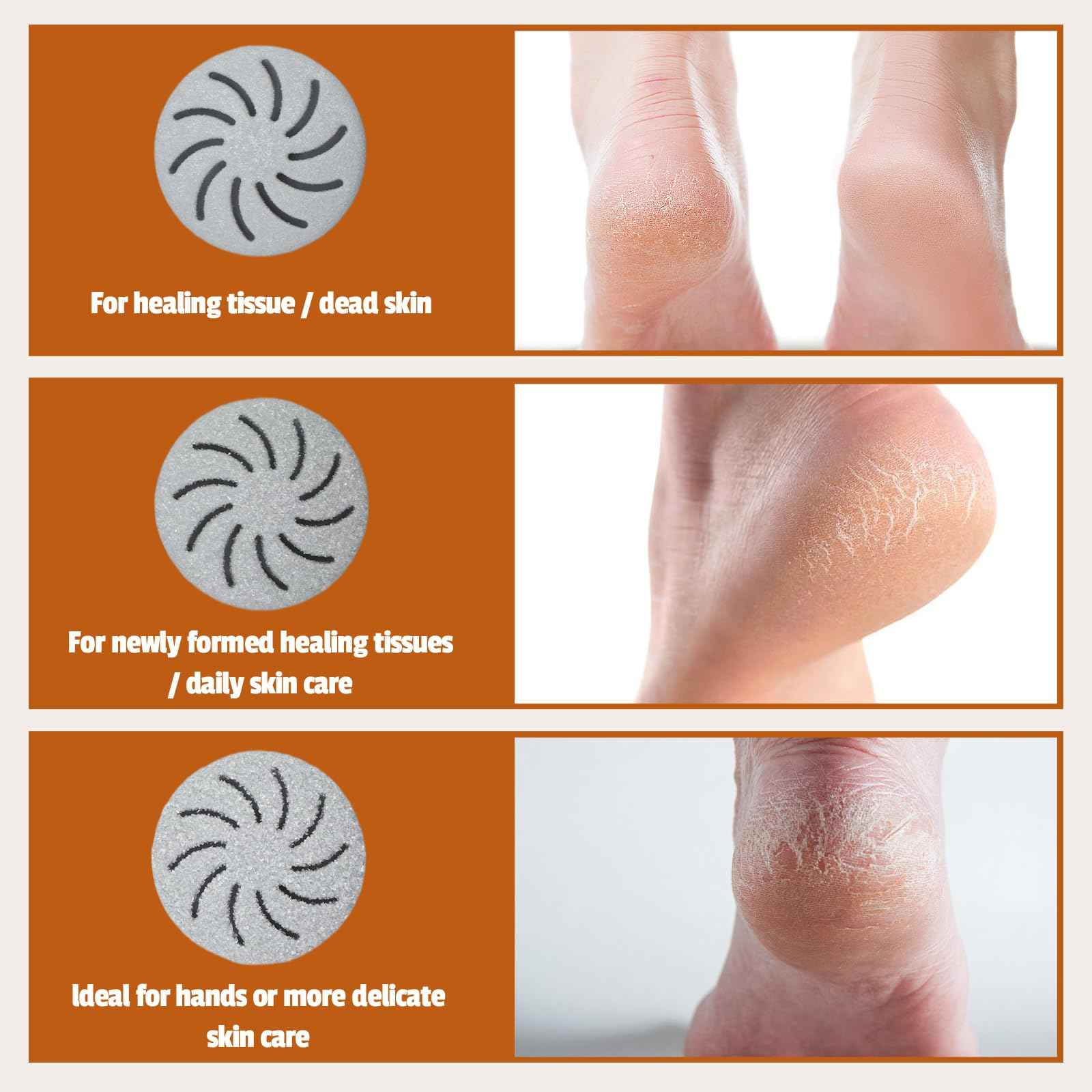 Meyluth Electric Foot Scrubber File Callus Remover with Absorb Function, Waterproof Foot Grinder Cracked Dry Dead Skin Removal for Feet Care, 3 Rollers, 2 Speed, Battery Display