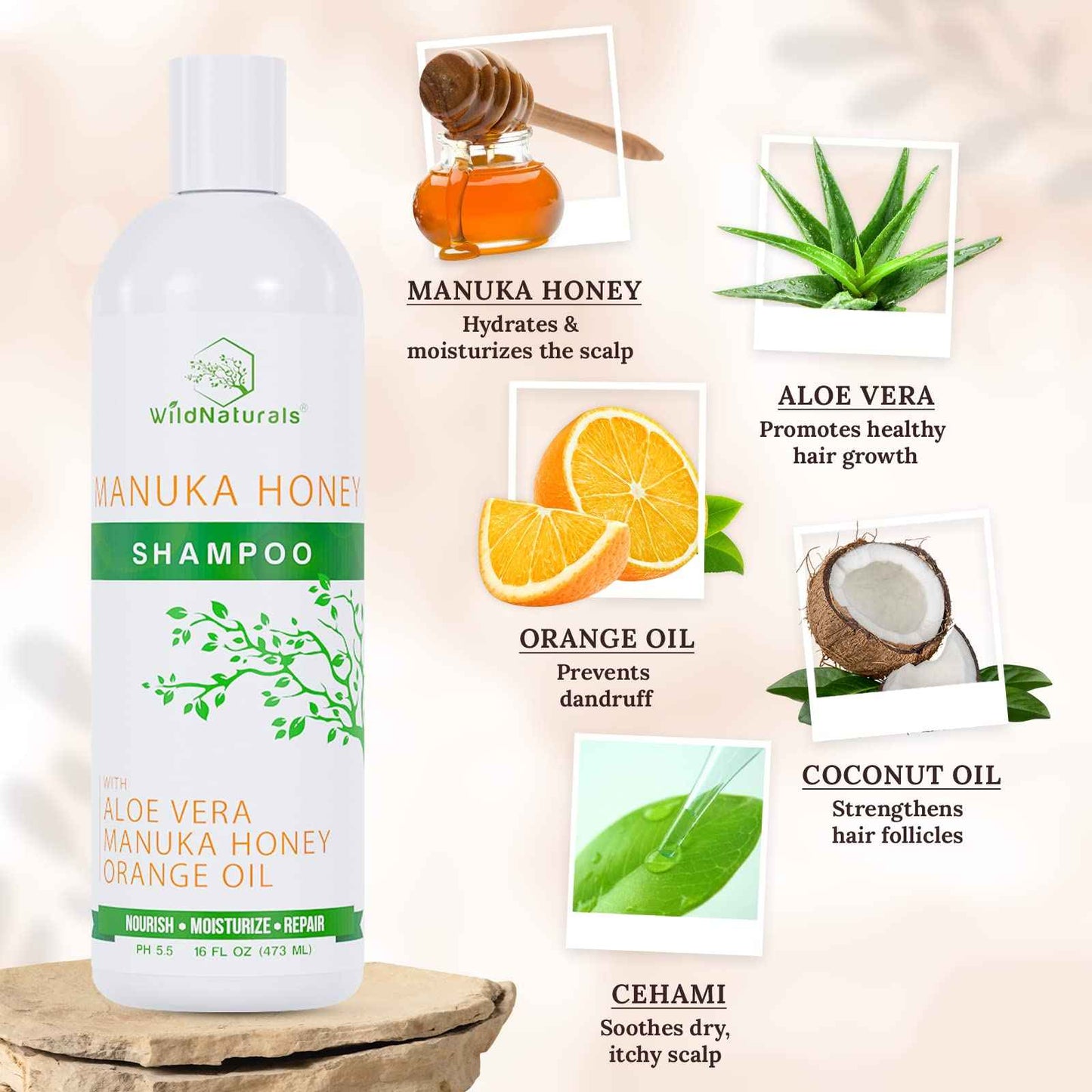 Eczema Manuka Honey Shampoo for Psoriasis and Dry, Itchy Scalp - Natural Hydrating Formula with Aloe Vera & Coconut Oil, Sulfate-Free