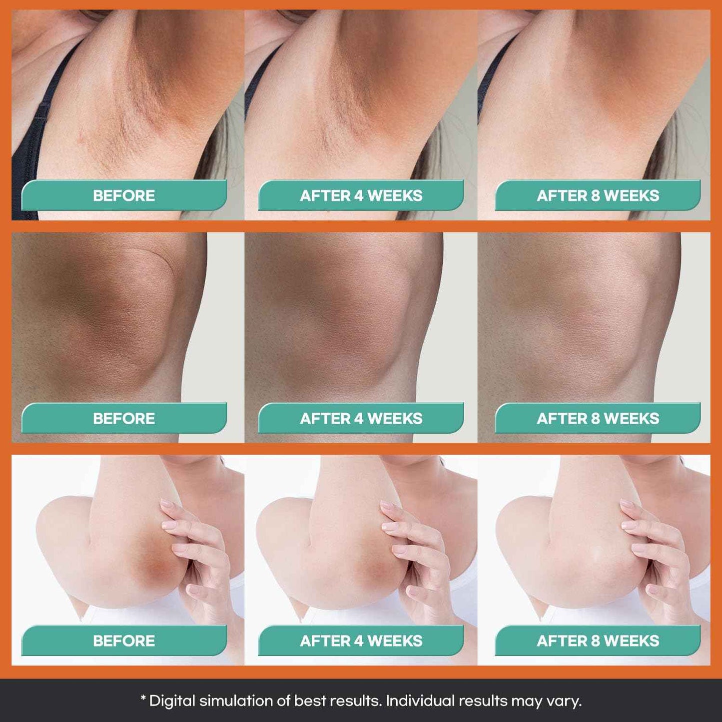 Natural Vine Dark Spot Corrector: Dark Spot Remover for Face and Body - Age Spot Brown Spot Sun Spot Remover Faded Spot Melasma Freckles Correcting - With Niacinamide for Women and Men 60g 2Pcs