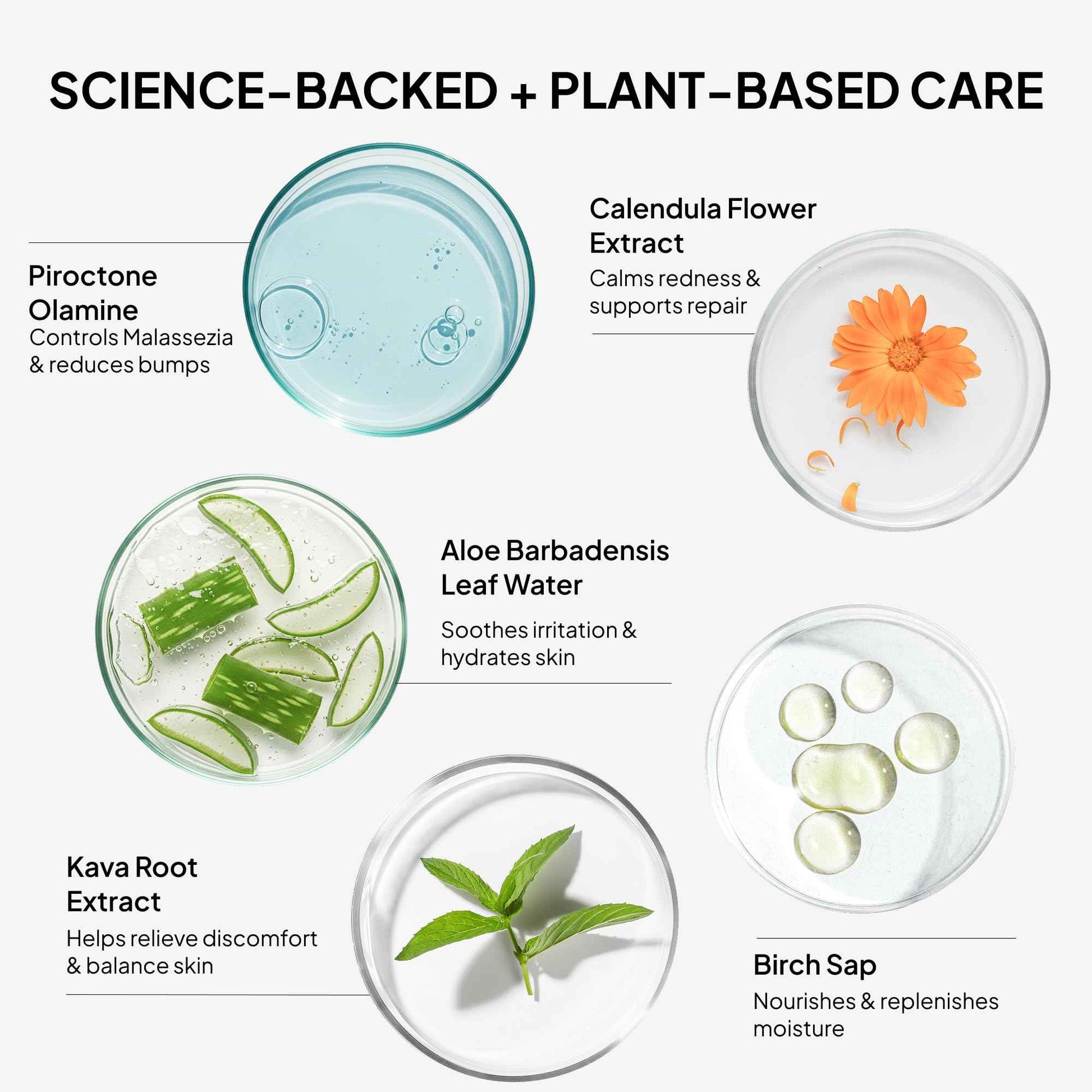 BellamiLuxx Fungal Acne Treatment Lotion: Effective Face & Body Pimple Cream for Bumps, Clusters, Itch & Redness – Fungal Prone Skin Acne Treatment Moisturizer for Teens & Adults with Natural Actives