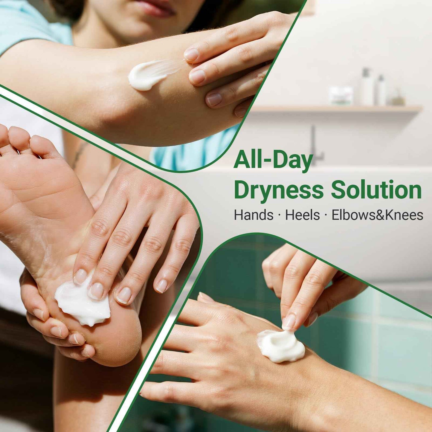 ishancare Moisturizing & Repair Cream with Urea – Intensive Treatment for Extremely Dry, Cracked Skin – Soothes Rough Hands & Heels – 200g Jar