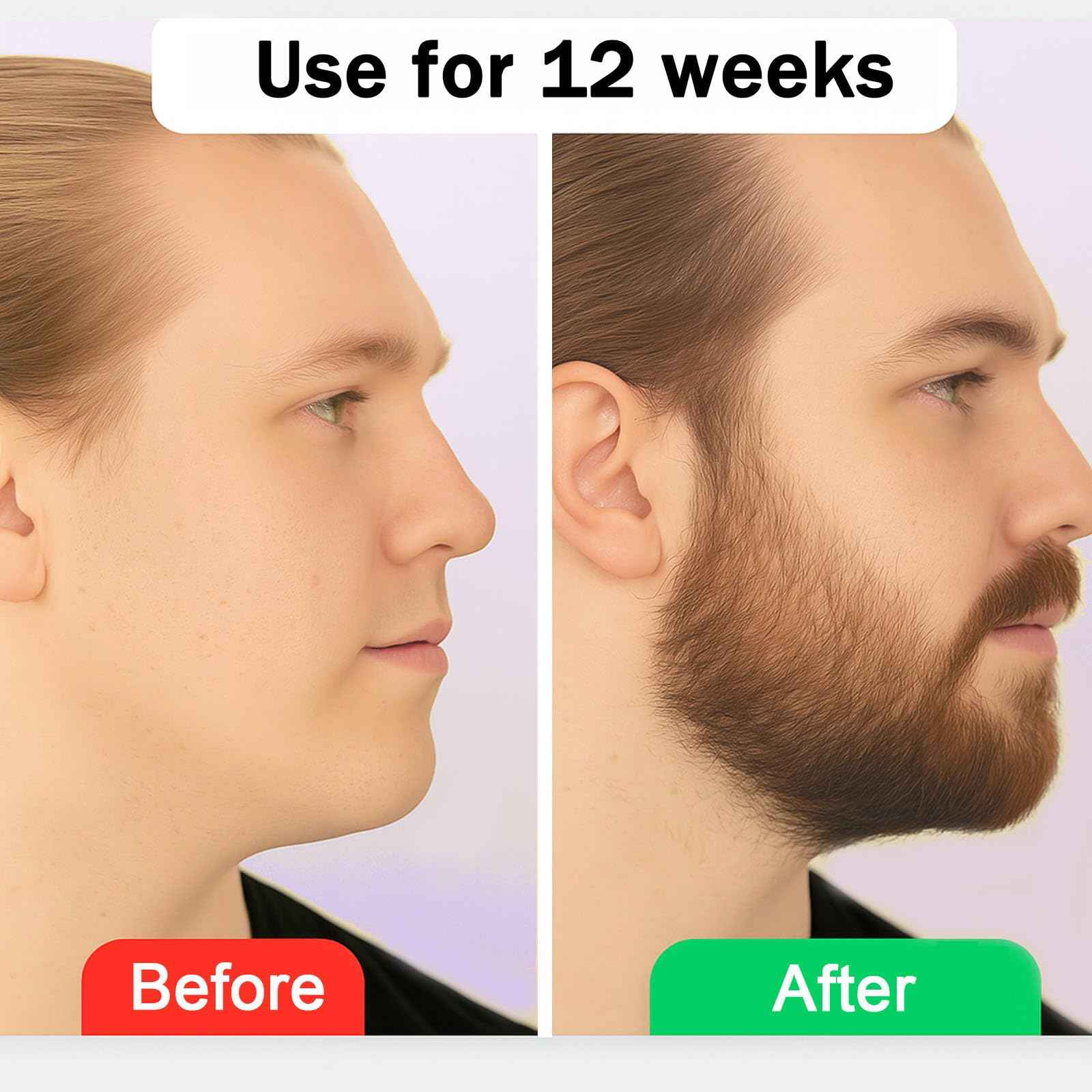 Estimulante Para Barba – Bálsamo de Crecimiento Ultra Potente, Beard Stimulating Balm, Moisturizes & Strengthens Beard, 100 ml / 3.5 oz