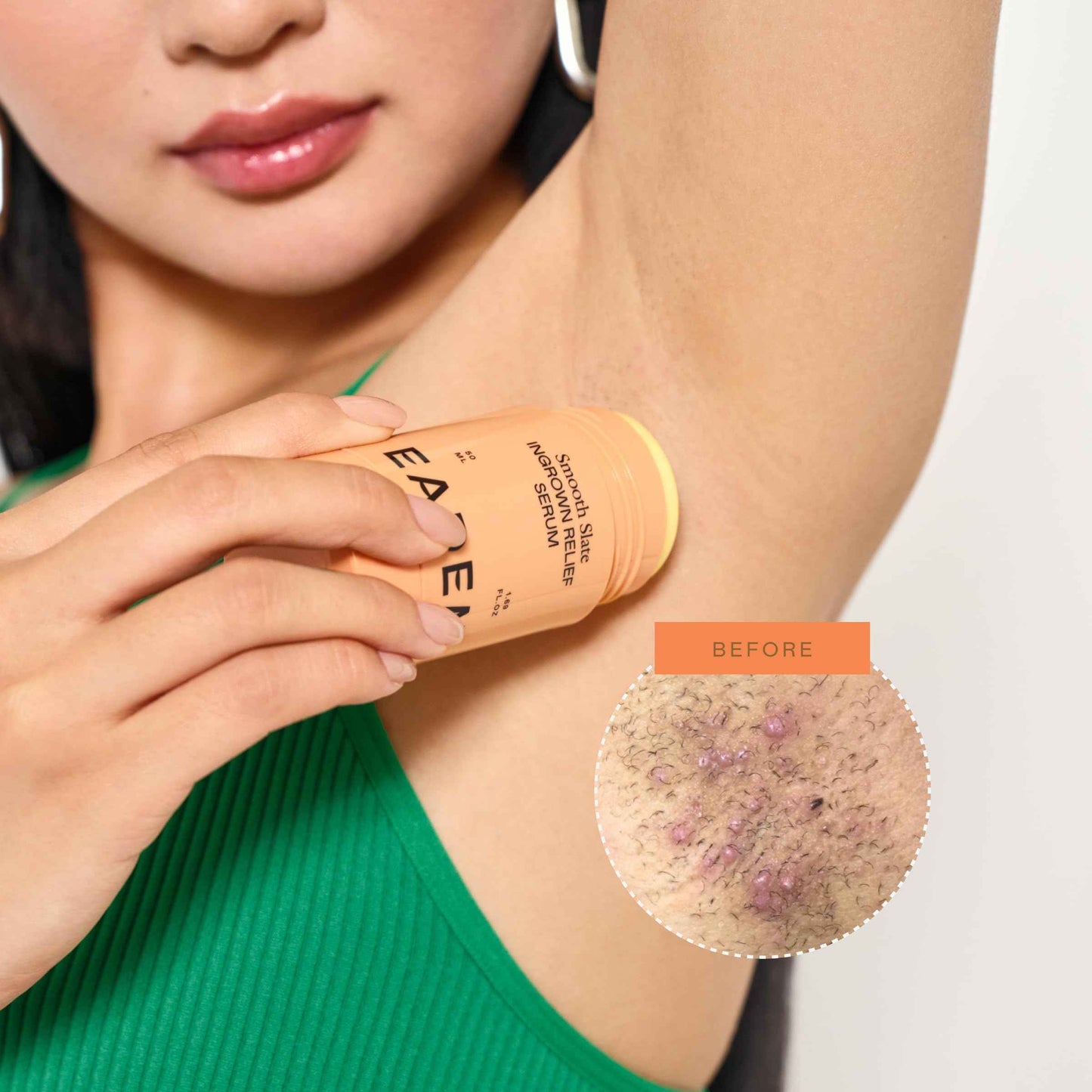 EADEM Smooth Slate Ingrown Hair Roller Serum, Targets Bumps Trapped Hairs, Faded Topicals for Scarring and Dark Spots, AHAs and Tyrosinase, Slows Ingrown Hair Regrowth