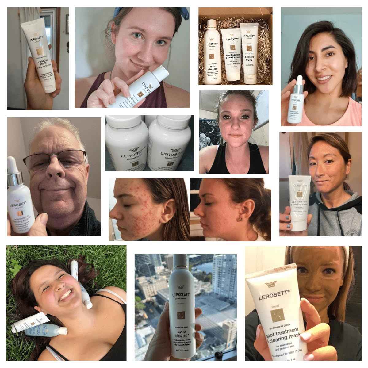 LEROSETT Oil-Free Moisturizer for Oily & Sensitive Skin, Lightweight Matte Hydration, Vegan Moisturizer, Aloe-Based with Vit-B5 + 7 Soothing Herbals, Non-comedogenic, Fragrance Free - 3 oz